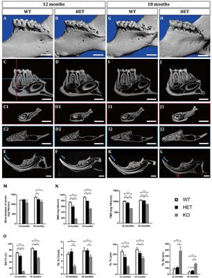 Haploinsufficiency of Dspp Gene Causes Dentin Dysplasia Type II in Mice